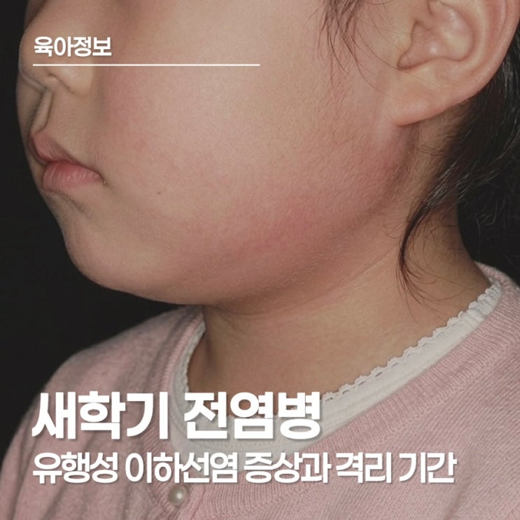  유행성이하선염(볼거리) 증상부터 격리 기간까지, 엄마가 알고있어야할 새학기 전염병
