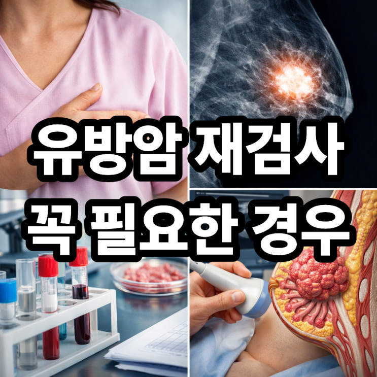  유방암 재검사 필요한 경우 총정리｜이럴 때는 꼭 다시 확인하세요