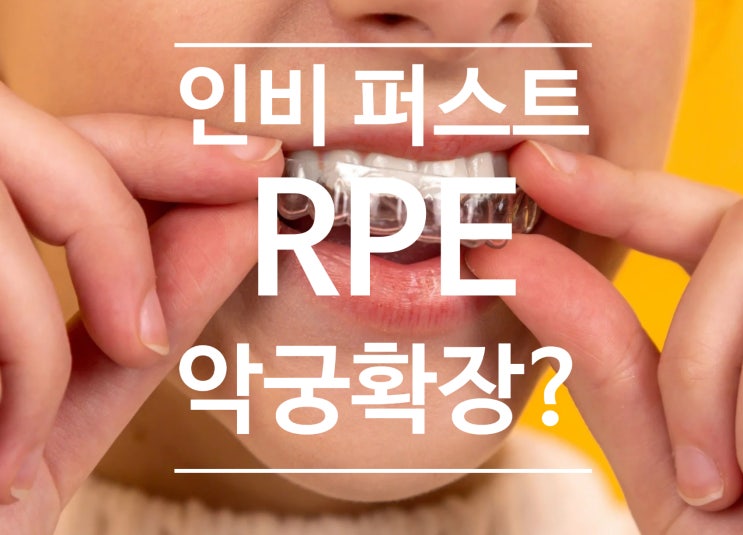  RPE(구개확장장치) vs 인비절라인 퍼스트, 어떤 장치가 우리 아이 악궁을 더 넓혀줄까요? 악궁확장, 상악확장