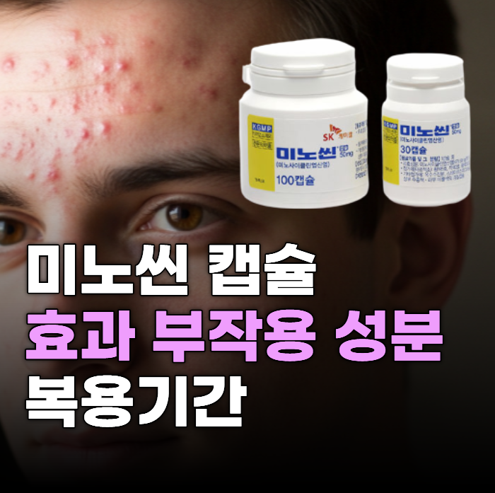 미노씬캡슐 50MG 효과 부작용 복용기간 성분 특징