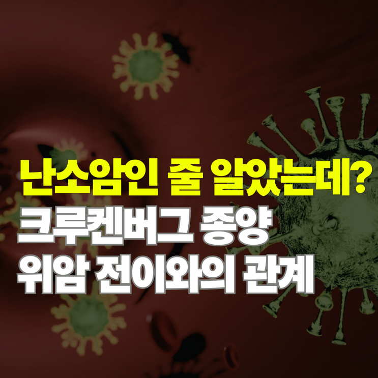  단순 난소암일까? 크루켄버그 종양 증상과 위암전이의 상관관계