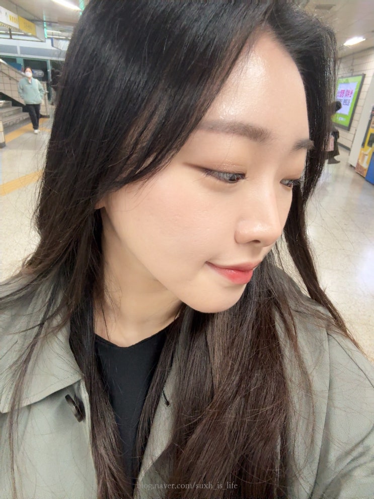  신논현피부과 쥬베룩스킨 여드름 흉터 효과 통증 소요시간 다운타임 2주 경과 솔직 후기