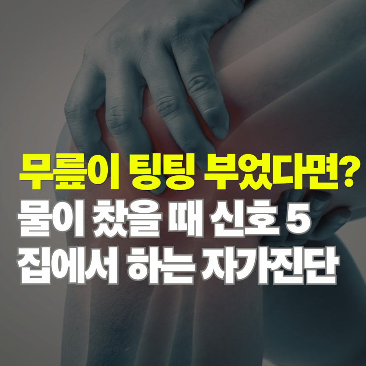  단순 부종일까? 무릎 물 찰 때 증상 5가지와 꼭 체크할 자가진단법