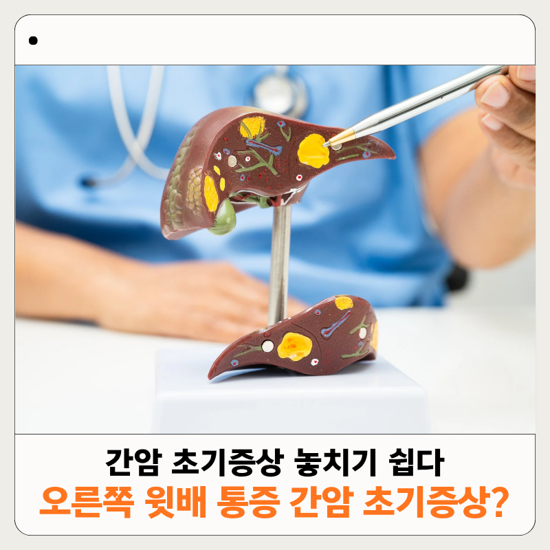 방치하면 돌이킬 수 없는 간암 증상! 이런 변화 보이면 이미 진행된 상태일 수 있어요
