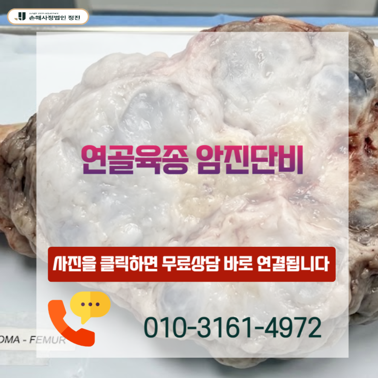  연골육종 암진단비, C코드인데도 20%만 지급? 전액 뒤집은 실제 기준 공개