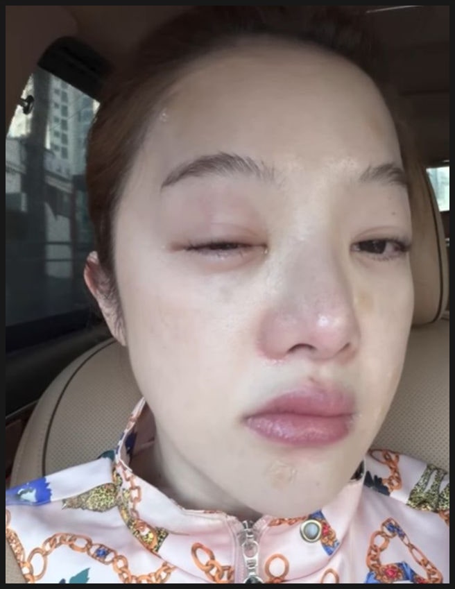  "난포가 안 보여요" 황보라, 9회차 시험관의 벽... 전문가들도 놀란 '엄마의 집념'