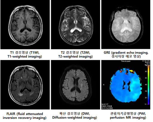 10. 뇌졸중(뇌경색·뇌출혈) 진단 방법 총정리: CT와 MRI, 어떤 차이가 있을까?