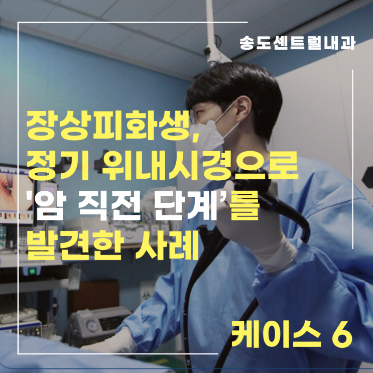  [케이스] 장상피화생, 정기 위내시경으로 ‘암 직전 단계’를 발견한 사례