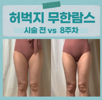 혜화역 안벅지 무한람스 8주 차 : 디자인이 만든 한 끗 차이, 라인변화!