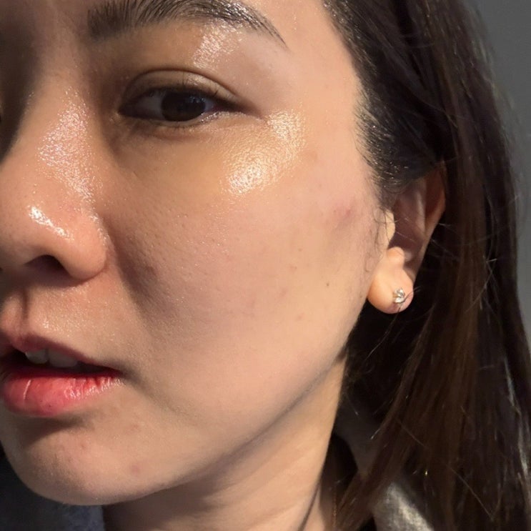  [해운대 피부관리] 부산 달맞이 비비에스테틱 물방울관리 후기, 비포에프터 확실한 리프팅