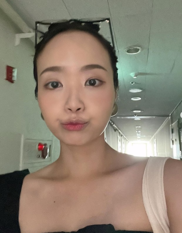 나는 솔로 29기 영철 정숙 결혼 앞두고 피부과 왜? 성형 싫다더니 입장 바뀐 이유
