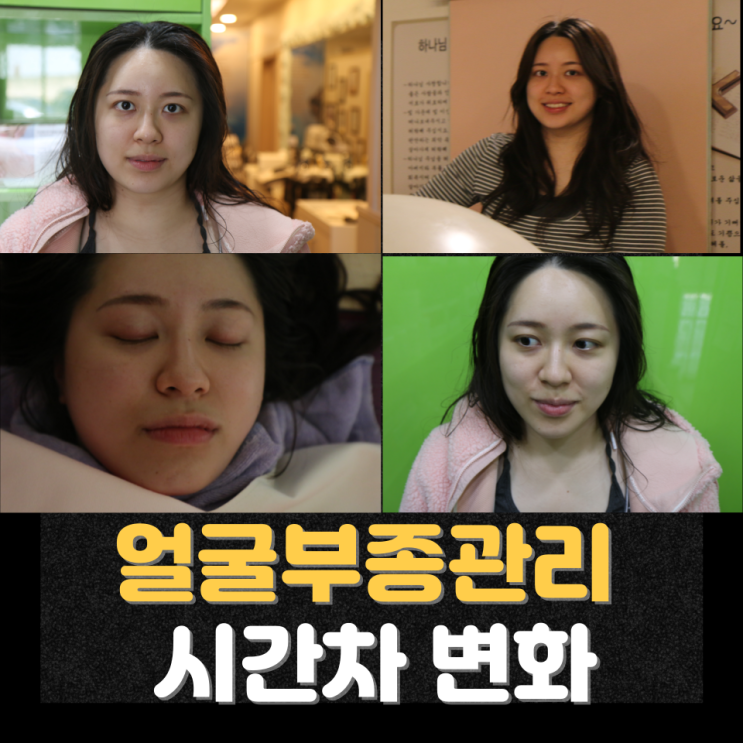  헤리티지 1차 관리와 천안쑥뜸관리 얼굴 복부 부종관리 1회차 얼굴부종 변화과정｜신부동피부관리
