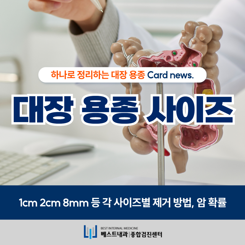 대장내시경용종크기 1cm 2cm 8mm 등 각 사이즈별 제거 방법, 암 확률