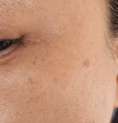 마데카솔 바세린 효과 정말 있는 걸까? 직접 해보고 알려드릴게요!!