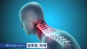 목디스크+아토피 있는 40대 집앤콕 메밀 경추베개 솔직후기