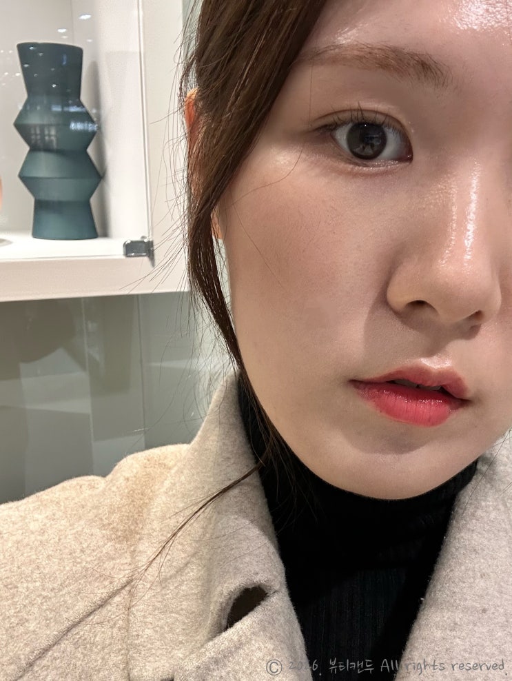  팔자주름 고민에 안아픈 울쎄라? 쿨소닉 5000샷 추천 강남역 피부과 레이저 후기