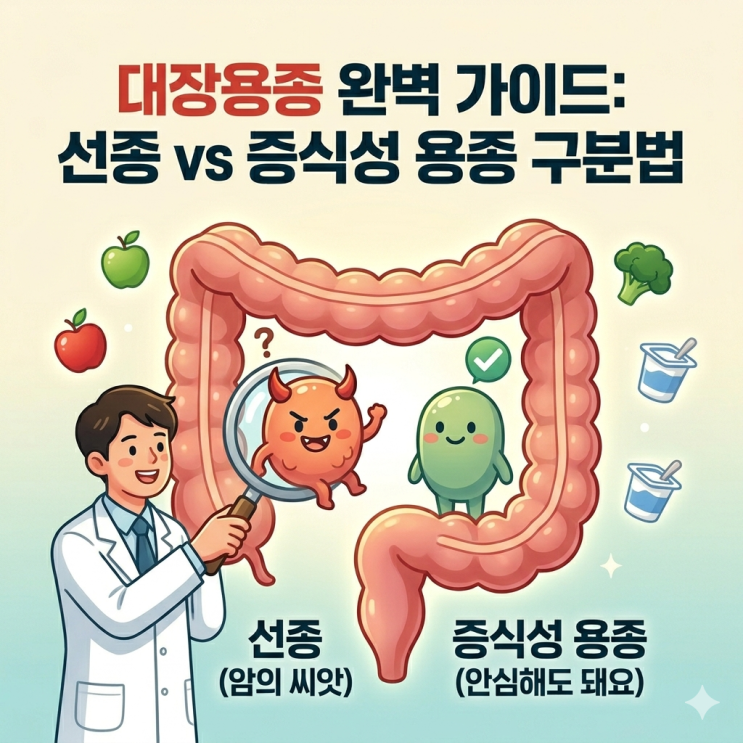  대장내시경에서 발견된 '혹', 무조건 암이 될까요? (떼야 할까 말까?)