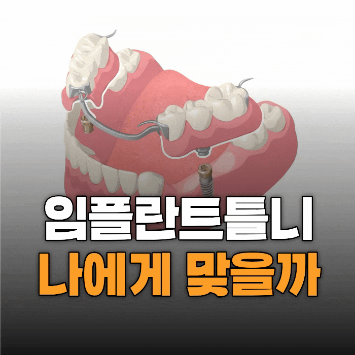  임플란트 틀니(IARPD), 전체 임플란트가 부담되신다면 이 글을 먼저 읽어보세요