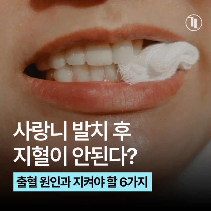 사랑니 발치 지혈이 안된다? / 지혈을 위한 6가지 / 지혈제란? / 강남레옹치과