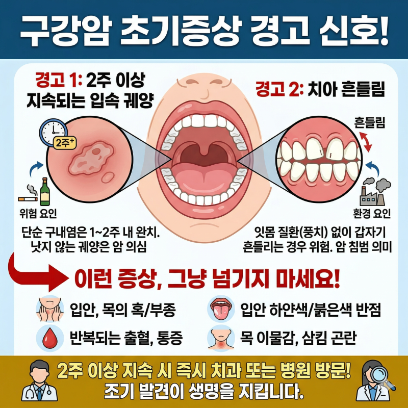 구강암 초기증상, 2주 이상 지속되는 입속궤양과 치아흔들림의 의미