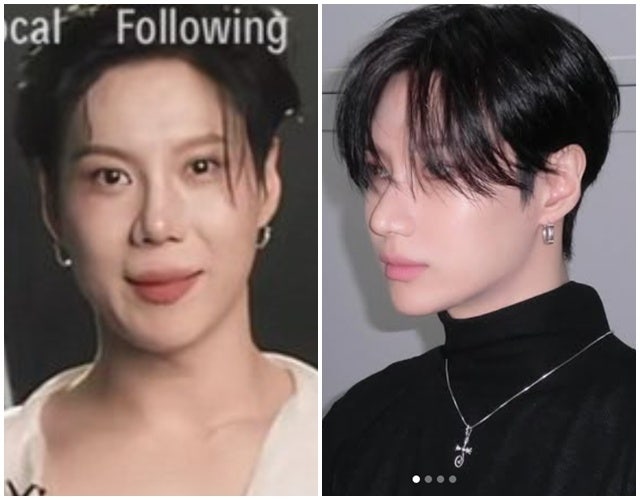 샤이니 태민, 성형설 논란…달라 보인 얼굴보다 더 먼저 봐야 할 포인트