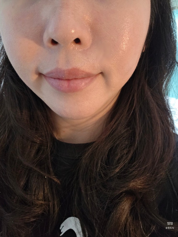  20년 경력의 청담피부과 잘하는곳 온다리프팅 내돈내산 후기