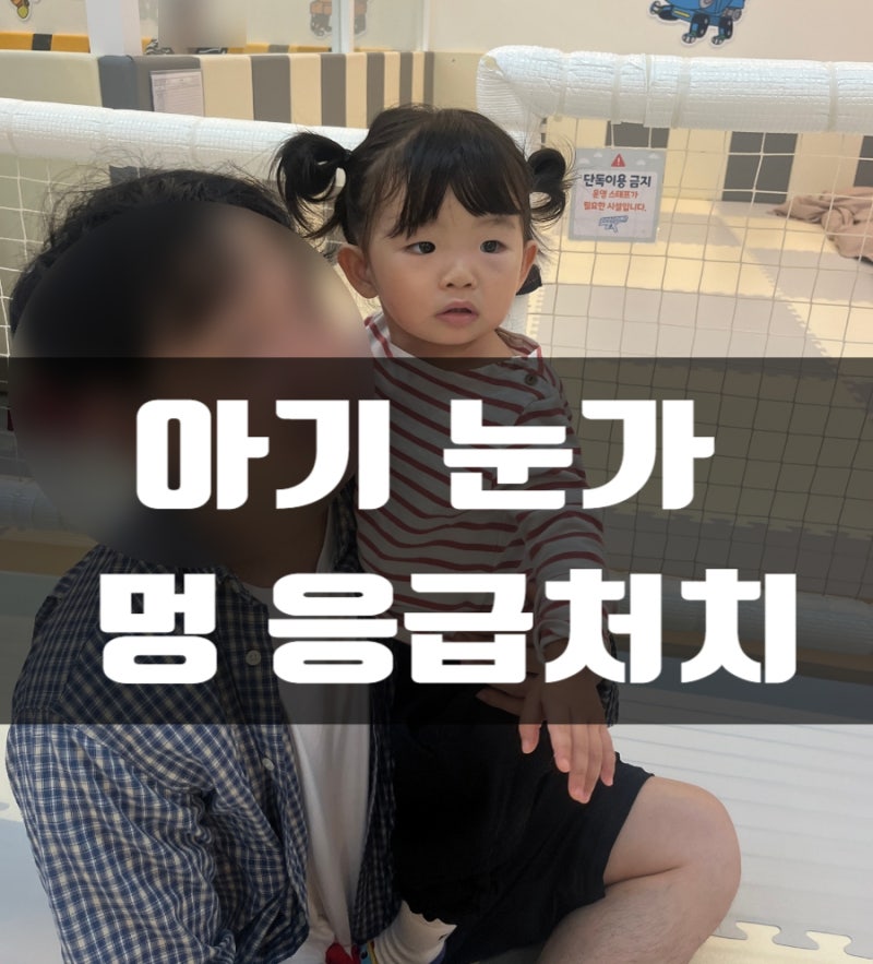돌아기 눈가 멍 응급처치, 아기 멍 연고 비판텐 대신 멍크림 발라본 후기
