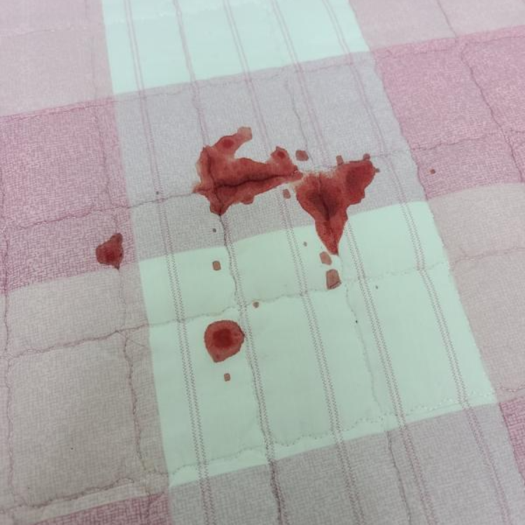 피 묻은 옷 지우기 세탁 방법 따로있다고 ?