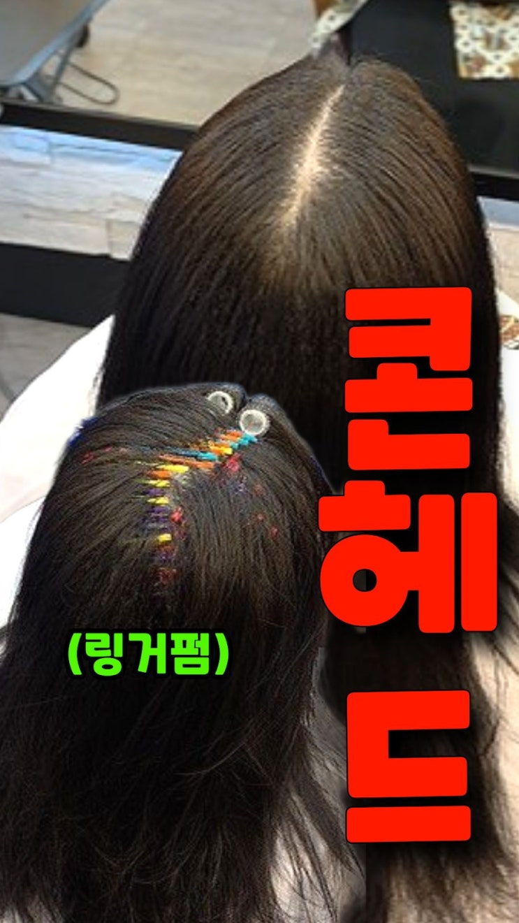  수원 링거펌으로 정수리 볼륨 살린 평택 고객 변신 후기