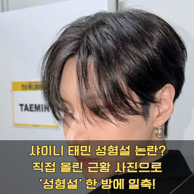샤이니 태민 성형설 논란? 직접 올린 근황 사진으로 '성형설' 한 방에 일축!