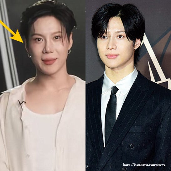 샤이니 태민 격변한 얼굴 근황, 코 성형 논란에 본인 직접 등판(독특한연예뉴스)
