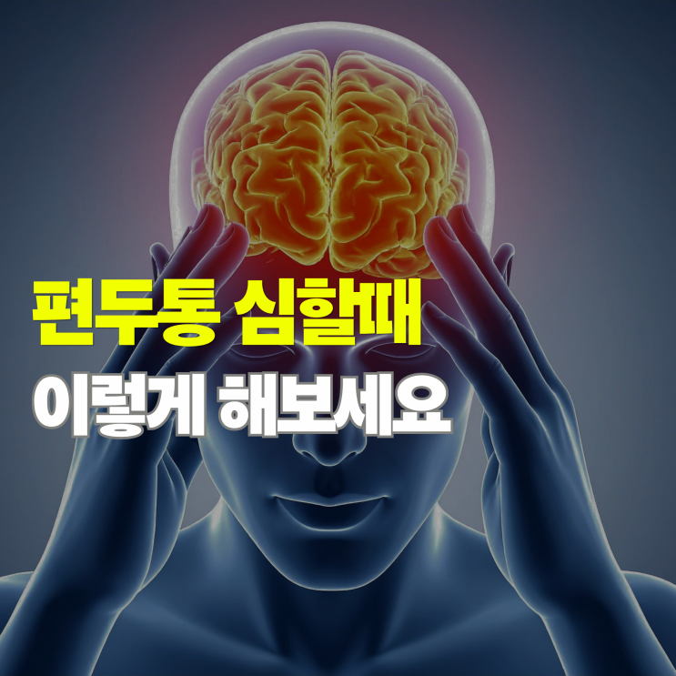  편두통 심할때 대처법, 약 먹기 전 이것부터 해보세요 (빠른 완화 방법)
