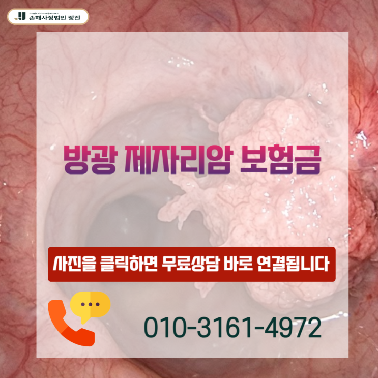  방광 제자리암 보험금 D090, 소액암 아닙니다 – 일반암 100% 받는 결정적 기준 공개