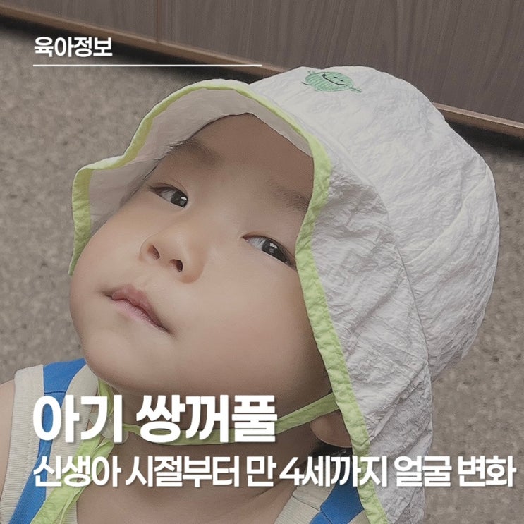  신생아 쌍꺼풀 라인, 사라졌다 나타나는 이유는?(만 4살 현재까지 기록)
