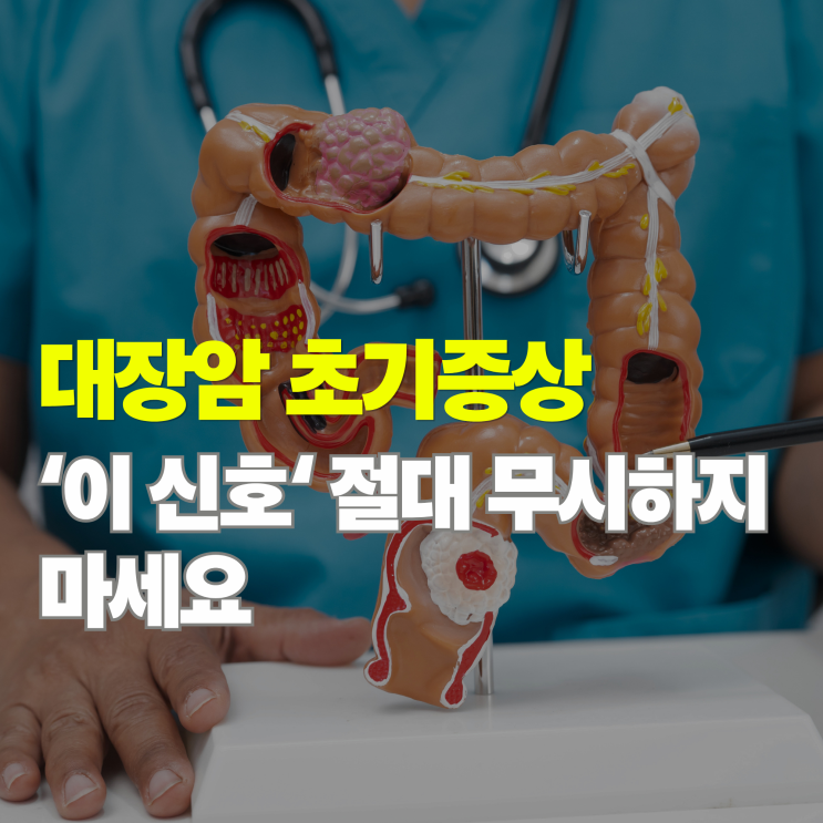  대장암 초기증상 5가지, 치질인 줄 알았는데 알고 보니 암 신호?