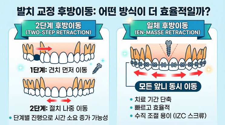 미니스크류를 활용한 발치교정에서 한번에 앞니 이동  VS 2단계 앞니이동! 어떤 방법이 더 효과적일까? 미니스크류 식립위치에 따른 효과 차이 분석