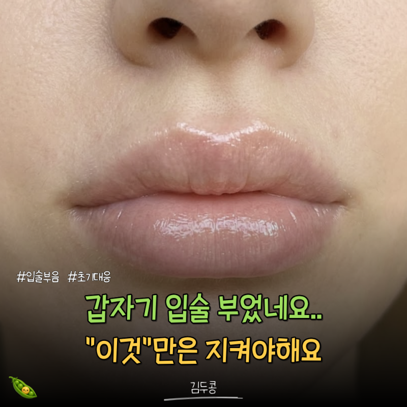 갑자기 입술 부음, 10분 안에 해야 할 "초기 대응"
