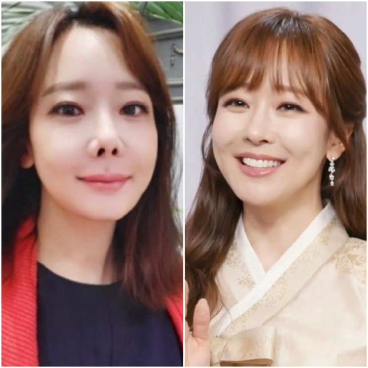  "남편 백종원 나락 갈뻔했는데.." 코 재수술하고 리즈 되찾은 여배우