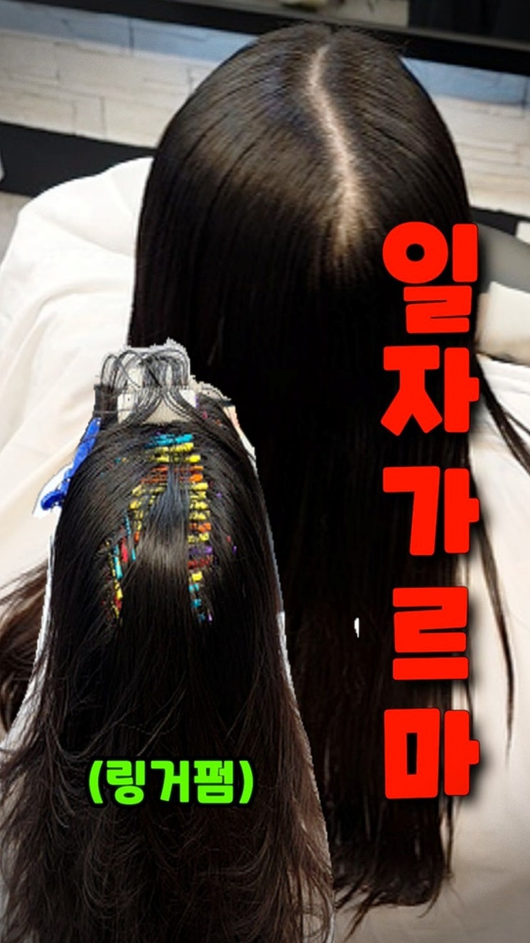  정수리 갈라짐 해방! 경기 용인 수지에서 수원 율전동까지 찾아온 링거펌 후기