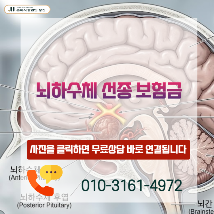  뇌하수체 선종 보험금, D35.2인데 포기하셨나요? 수천만 원 뒤집는 결정적 기준 공개