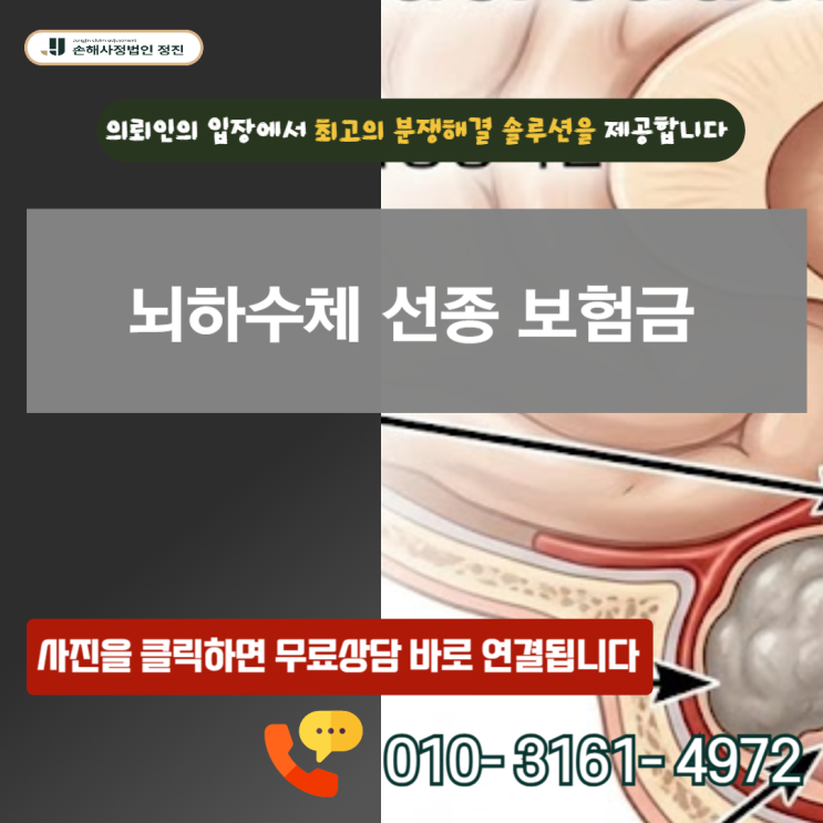  뇌하수체 선종 보험금, D35.2인데 200만 원만 받으셨나요? 5천만 원 뒤집는 결정적 기준
