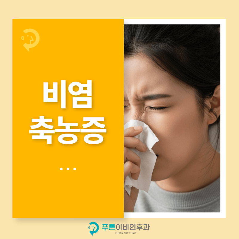 울산 코막힘, 맑은 콧물은 비염, 누런 콧물은 축농증일까?