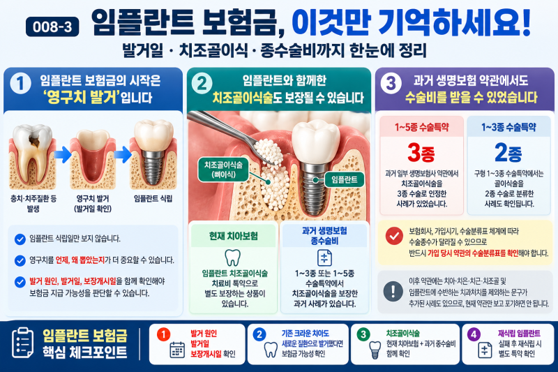 008-3 | 임플란트 보험금 받을 수 있을까? 발거일·치조골이식·종수술비까지 정리
