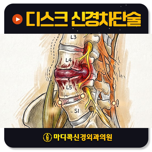 안성 허리디스크 병원? 주사 맞고 좋아지셨던 분들의 공통점