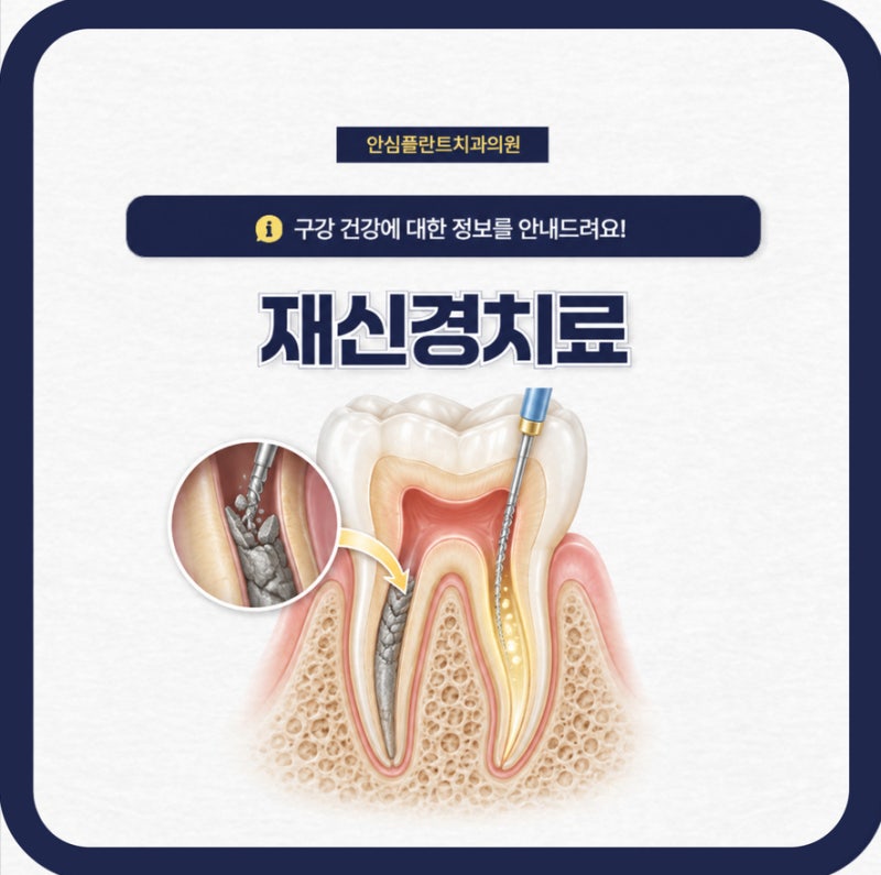 재신경치료 통증이 있고 색이 점점 어두워진다면?