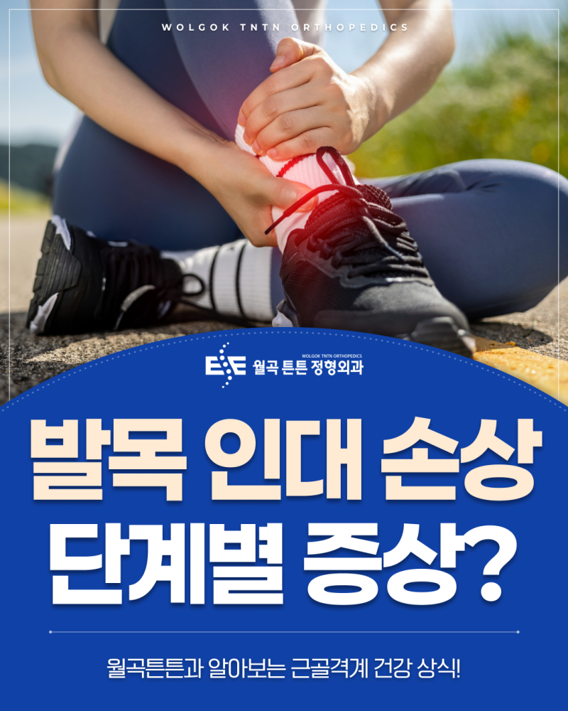발목을 삐끗한 뒤 붓기가 계속된다면, 발목 인대 손상 단계별 증상
