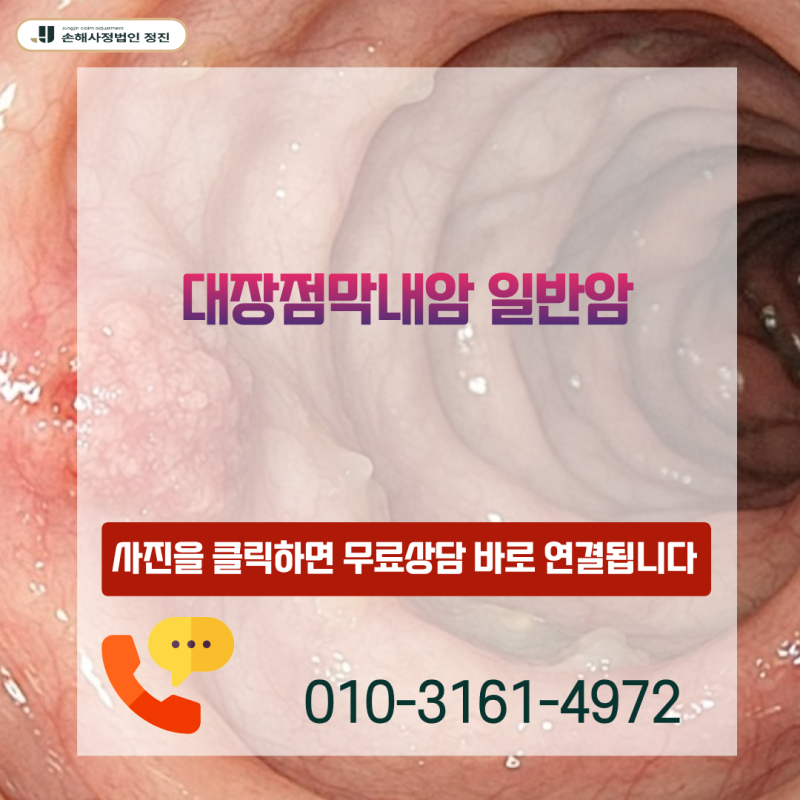 대장점막내암 일반암, D01 질병코드인데 전액 보상 가능할까요?