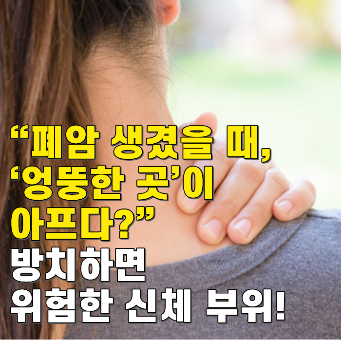 “폐암 생겼을 때, ‘엉뚱한 곳’이 아프다?” 방치하면 위험한 신체 부위!