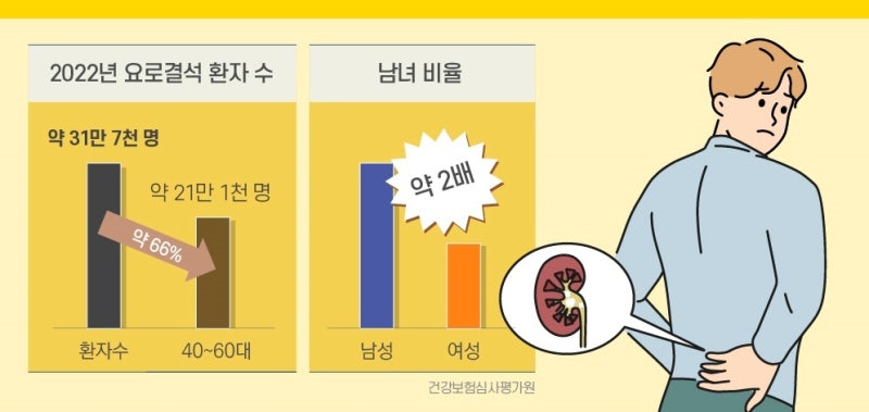 요로결석은 언제 자연배출을 기대할 수 있을까