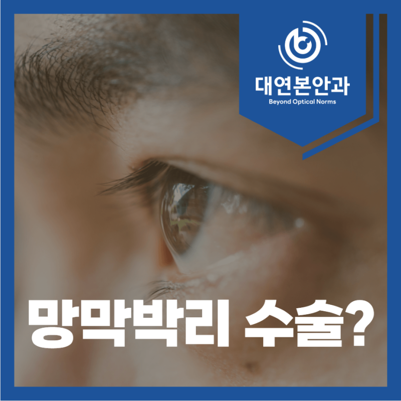부산 동래구 안과, 망막박리 수술을 제안받았을 때 확인할 기준